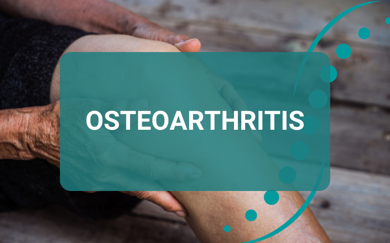 Osteoarthritis | Progressive Chiropractic Berwick