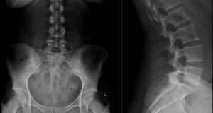 Do I need x-rays to see a chiropractor?